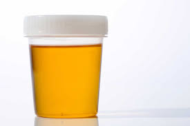 urine infections urine color what