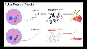 spinal muscular atrophy mechanism