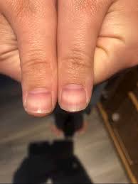 nail changes can anybody tell me if