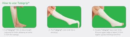 Tubigrip Tubular Bandage Size Chart