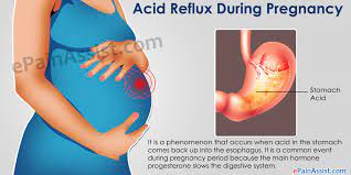 acid reflux during pregnancy home