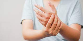 carpel tunnel syndrome cts in