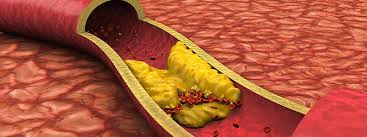 Image result for Cholesterol