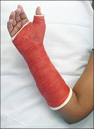 Splints And Casts Indications And Methods American Family