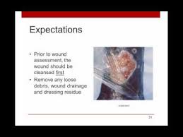Woundrounds Webinar Wound Assessment Documentation A Practical Guide