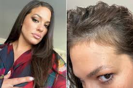 ashley graham s hairline is growing