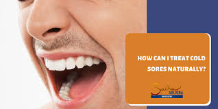 how can i treat cold sores naturally