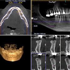 cbct cone beam computed tomography