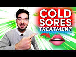 how to get rid of a cold sore on lip