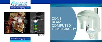dental cone beam ct iranian surgery