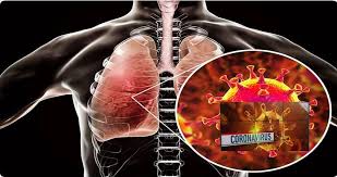 कोरोना का वार: फेफड़ों पर ऐसे अटैक करता है कोरोना वायरस - Corona virus attacks on lungs in many ways Trouble breathing prsgnt