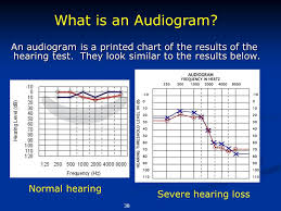 Hearing Loss Prevention Rule Noise Wac Ppt Download