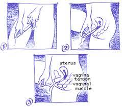 How to use tampons diagram. Tampons Using Your First Tampon Center For Young Women S Health