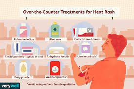 heat rash pictures treatment and
