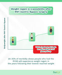 reverse weight gain after gastric