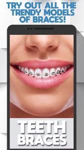 Arranque o dente das pessoas, brinque com dentaduras e perfure cavidades em um de nossos jogos de dentista online e gratuitos! Falso Aparelho Dental Aplicativo Dentista Virtual Para Android Apk Baixar