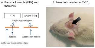 Healthcare | Free Full-Text | Regulatory Role of Orexin in the Antistress  Effect of “Press Tack Needle” Acupuncture Treatment