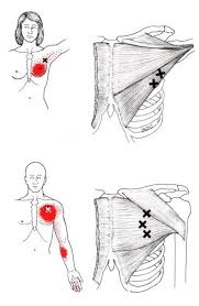 trigger points affecting the chest