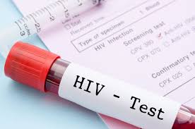 what are the early signs of hiv and how