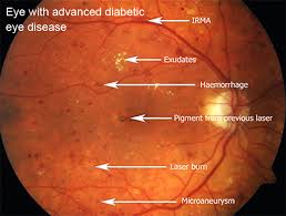 Image result for fundus photography