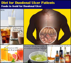 Diet For Duodenal Ulcer Patients