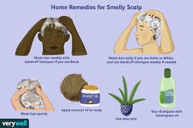 smelly scalp causes home remes