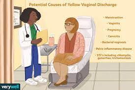 yellow inal discharge what s normal