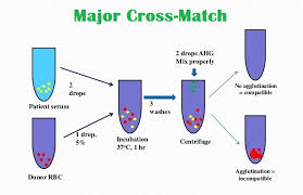 Cross Matching Types Purpose Principle Procedure And