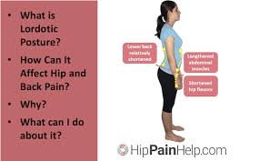 At times an individual might experience pain in more than one area. Causes Affects Exercise For Lordosis And Hip And Back Pain