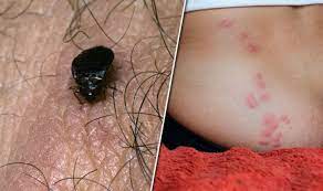 bed bug bites prevent signs of insects