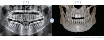 dental x rays on wa 3d ct scan