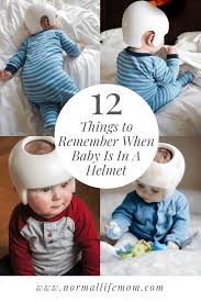 What Parents Need To Know About A Baby Helmet Normal Life Mom