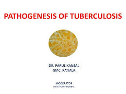 Pathogenesis Of Tuberculosis Authorstream