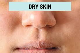 dry and ling skin around nose 13