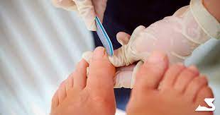 diabetic nail and skin care