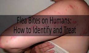 flea bite on human flea bites vs