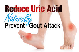 home remes to reduce uric acid