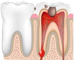 how dangerous is an infected tooth