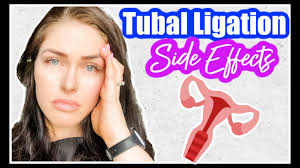 tubal ligation side effects 1 year