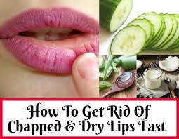 cure chapped lips naturally