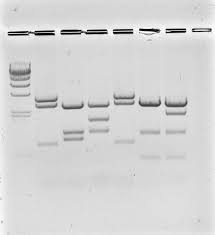 A dna fingerprinting is a dna pattern that has a unique sequence such that it can be distinguished from the dna pattern of other individuals. Https Www Bio Rad Com Webroot Web Pdf Lse Literature 1660077edu Pdf