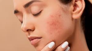 beauty tips how to manage dry skin