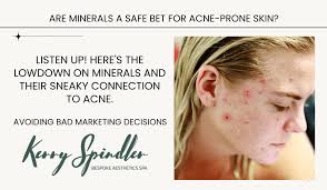 are mineral s bad for acne e