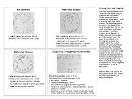 clock drawings and test scores for