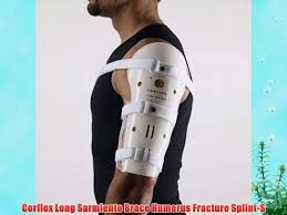 Until approximately age 3 years, child abuse (usually a twisting injury) is the most common. Corflex Long Sarmiento Brace Humerus Fracture Splint S Video Dailymotion
