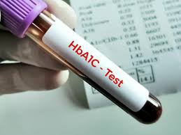what is a1c hb1ac test its levels