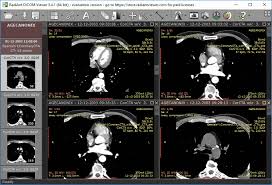 Weasis is a free dicom viewer which requires java runtime environment 6 or later to run. 16 Best Free Dicom Viewer Software For Windows