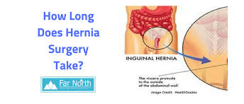how long does hernia surgery take