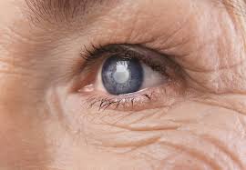 is cataract surgery painful healing