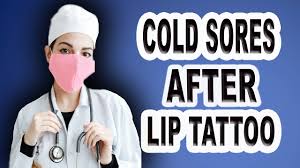 cold sore after lip tattoo you